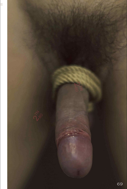 51