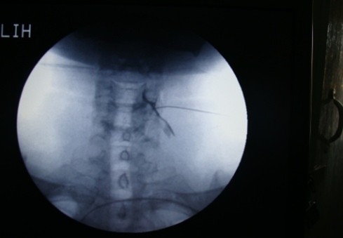 Image 5 - Procedure