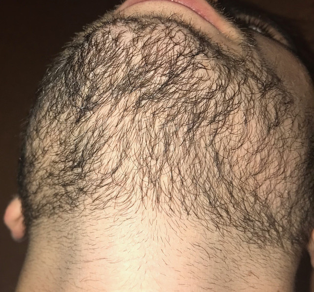 IMG 1025