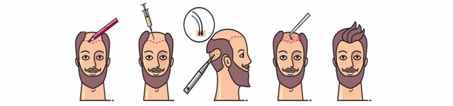 microfue-e1536442200484