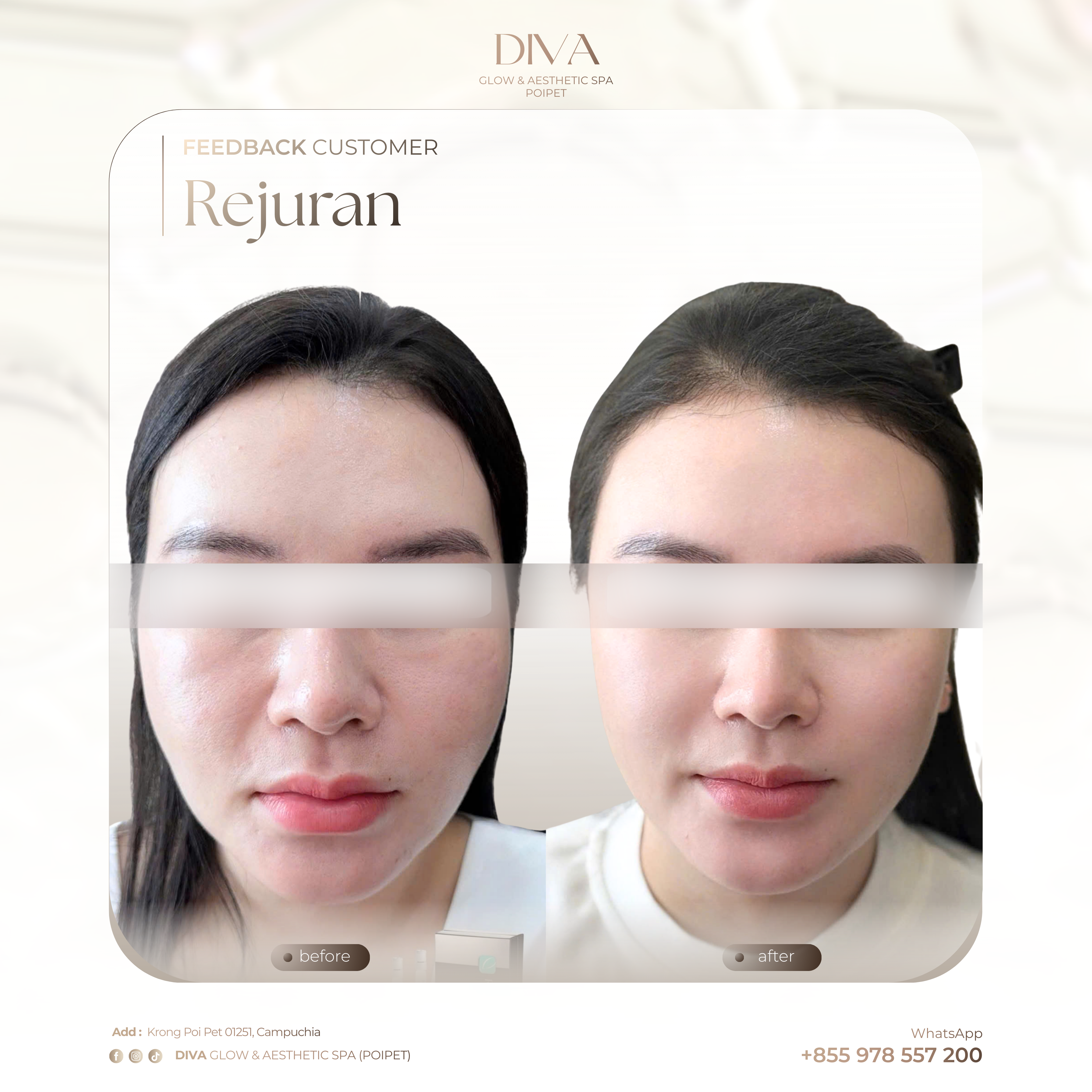 DIVA Skin Clinic Poipet