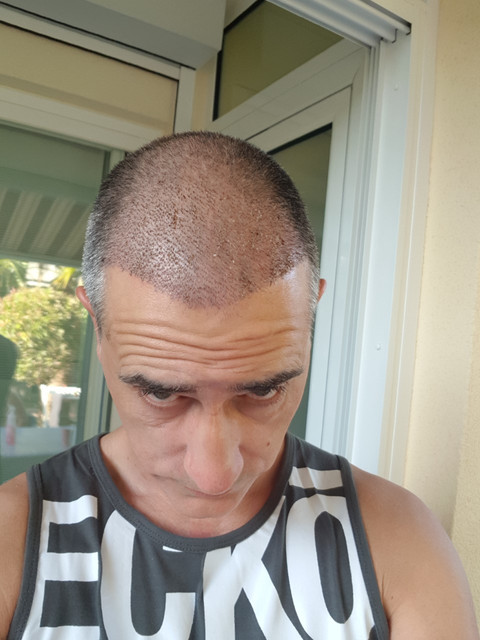 10DIAS