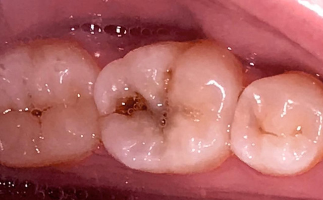 IMG-3220