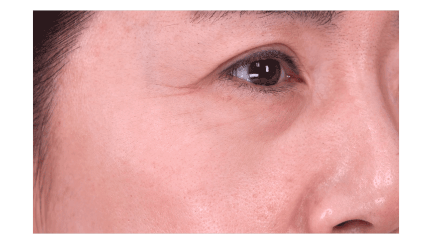 Multi Collagen Wrinkle Balm 01 04