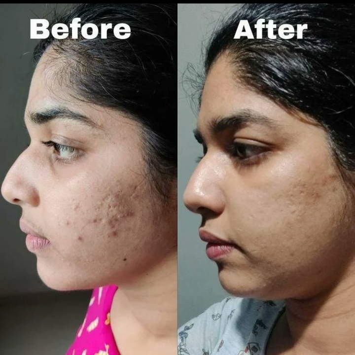 Real Women Real Results