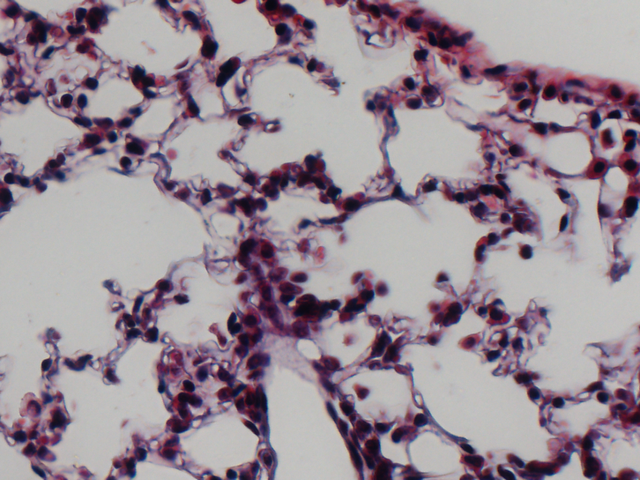 lung-tissue