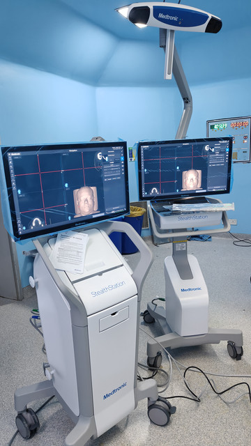 Neuronavigation system