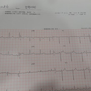 Heart Exam