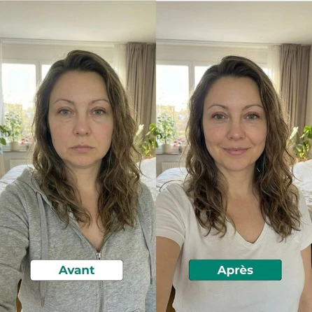 Avant et après le protocole 14 jours