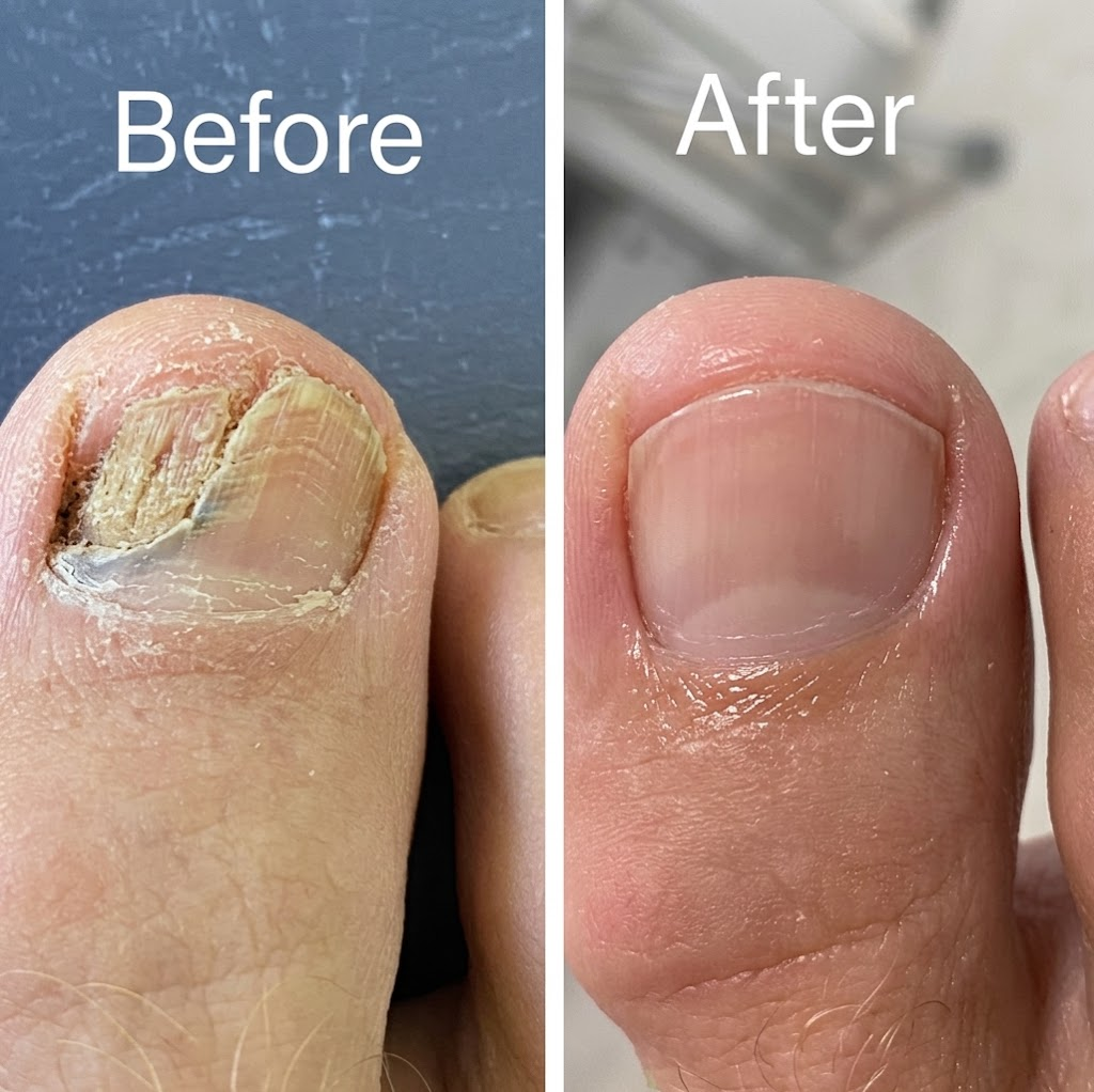 NailCarePen customer result
