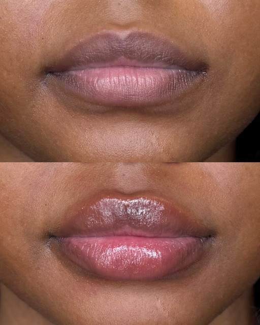 Lipparazzi Instant Filler Lips before and after