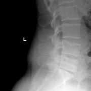 xray4