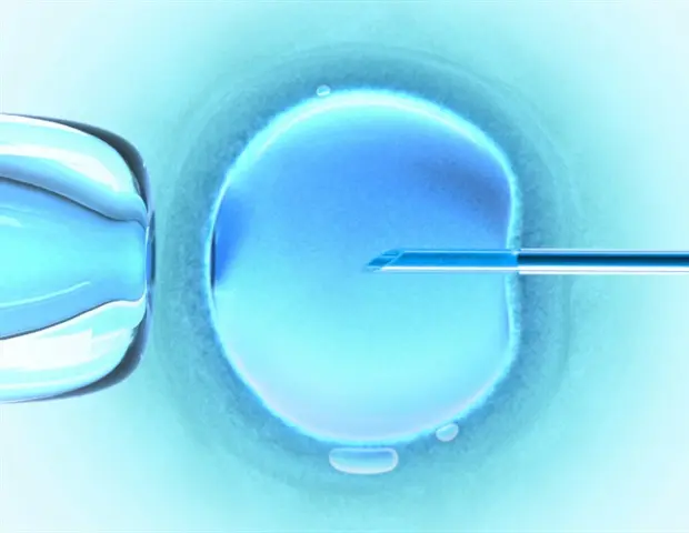 Infertility Linked to Earlier Menopause