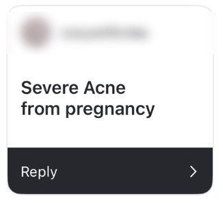 Story reply
