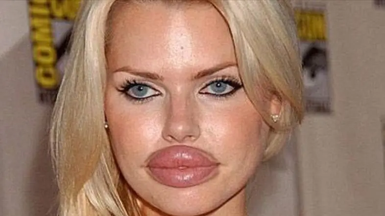 Why Can't We Get Enough of Botched Beauty Procedures?