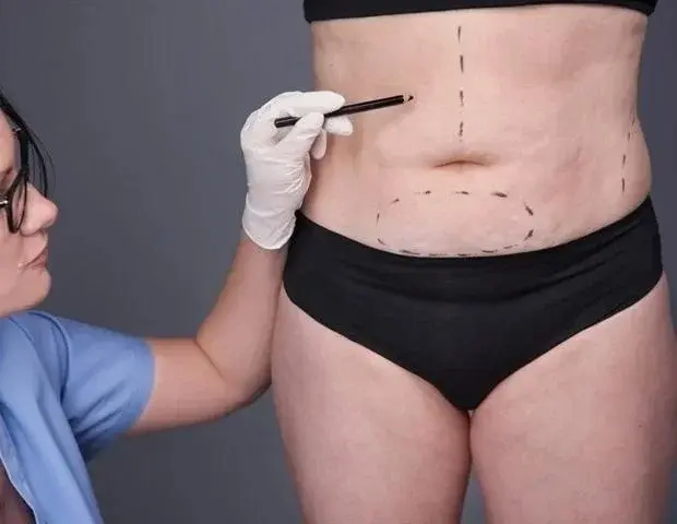 Obesity Treatment Shifts: GLP-1 Drugs Gain Popularity