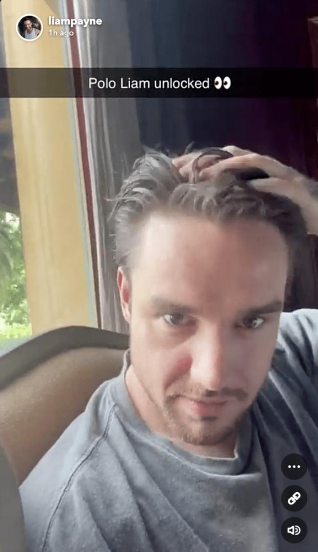 “Según lo que vio el equipo, aparentemente había una fractura craneal y lesiones extremadamente graves que llevaron a su muerte inmediata”, dijo el profesional médico sobre el cantante, visto aquí en su último video de Snapchat.