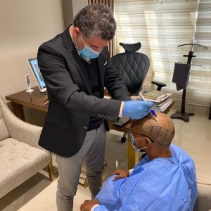 د. علاء حجاج يرسم خط الشعر الأمامي لمريض قبل عملية زراعة الشعر