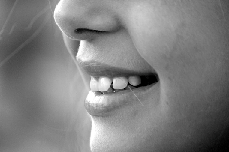 Wisdom-Teeth-in-Sydney