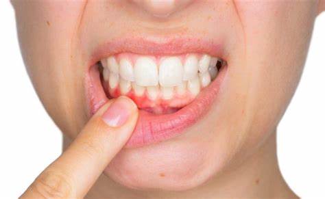 Top Signs You Should See a Periodontist