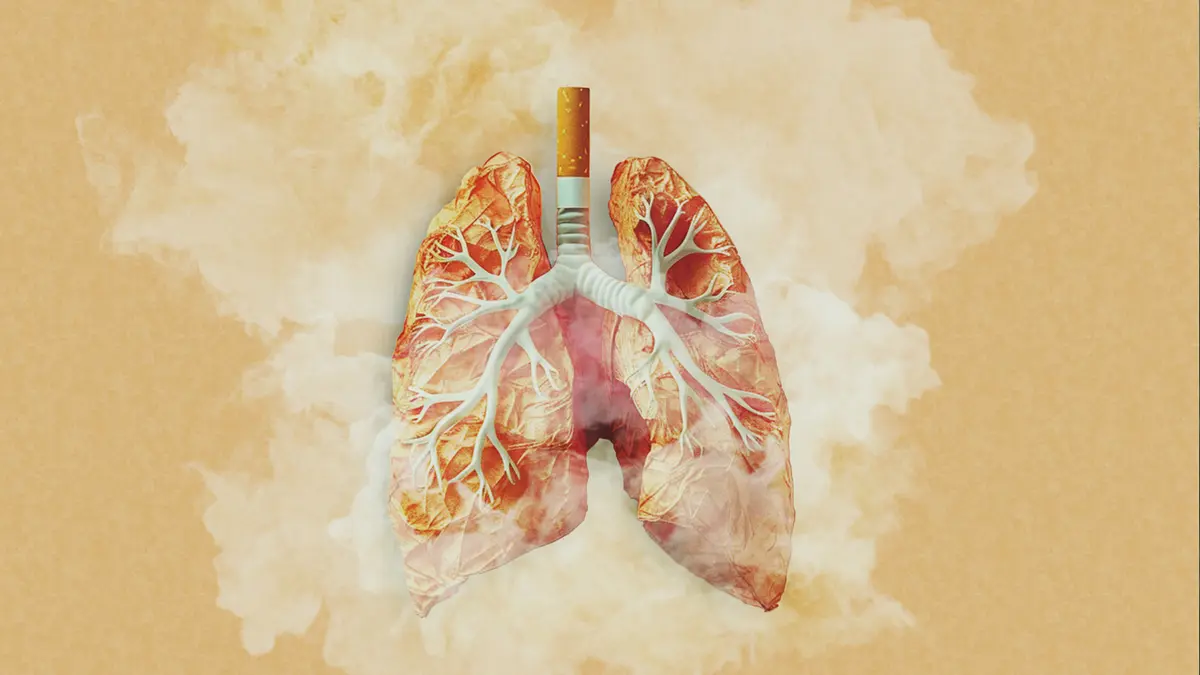 Linia nelimitată dintre anxietate și dependență