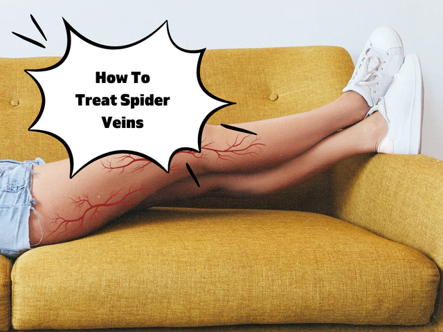 a-leg-wearing-rubber-shoes-with-spider-veins-on-the-calf-with-the-alt-text-at-the-left-side-of-the-i