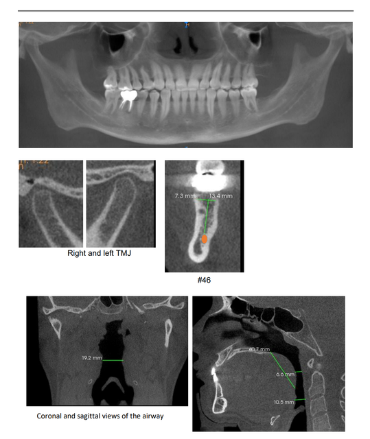 cbct