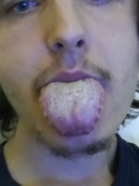 mde