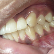 P1050544