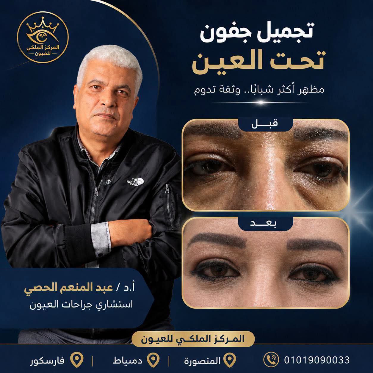 صورة الخبر