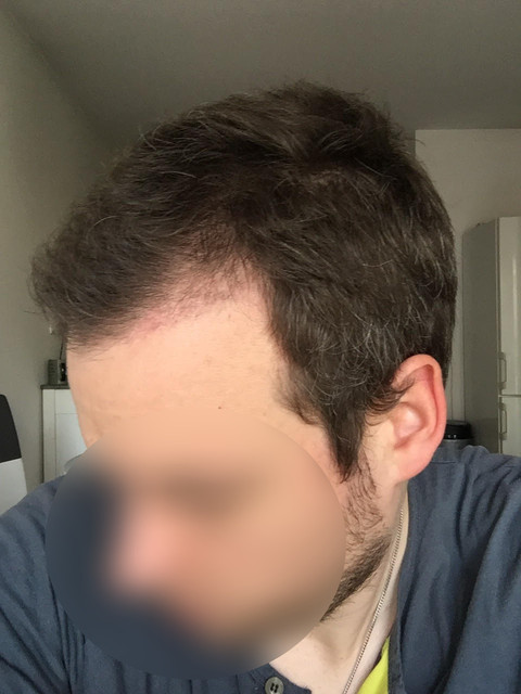 M 3 4