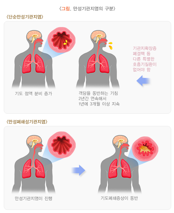 만성 기관지염 증상 주의점