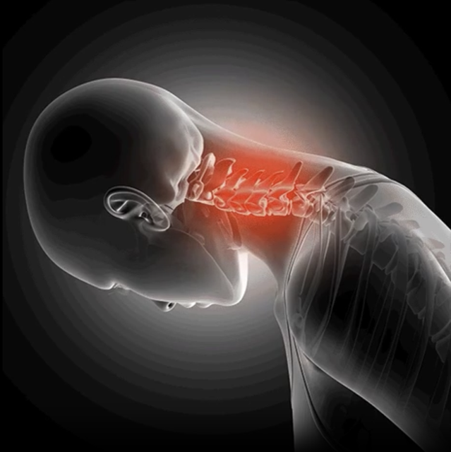 Soulager vos douleurs cervicales et maux de tête à domicile.