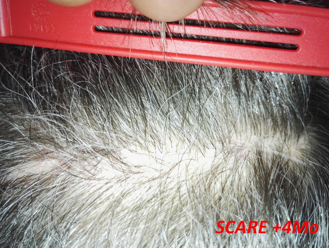 Scare-4mo-6.jpg