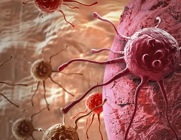Aggressive Head and Neck Tumors Revealed through Imaging