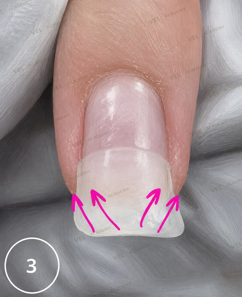 PolyGel restoration step 3 distributing material across free edge