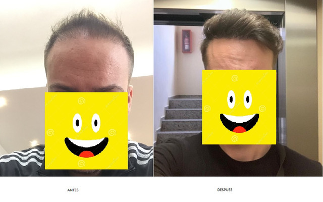 RESULTADO