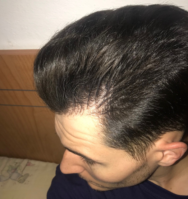 IMG 0342