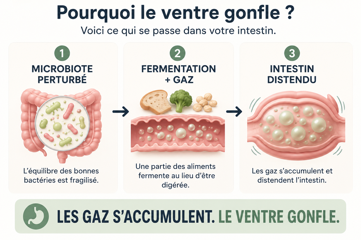 Schéma du mécanisme du ballonnement : équilibre du microbiote perturbé, fermentation, gaz, intestin distendu