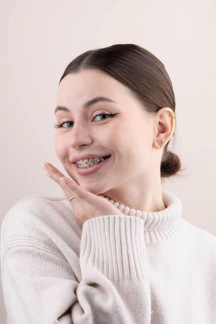 Lo que nadie te dice sobre usar brackets a los 30