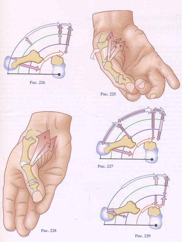 htmlconvd-Dp-Rplr301x1.jpg