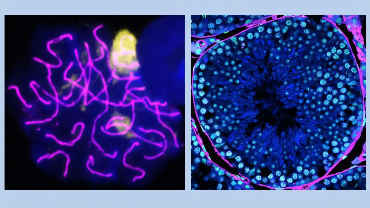 Male Fertility Declines with Age Due to Overlooked Protein