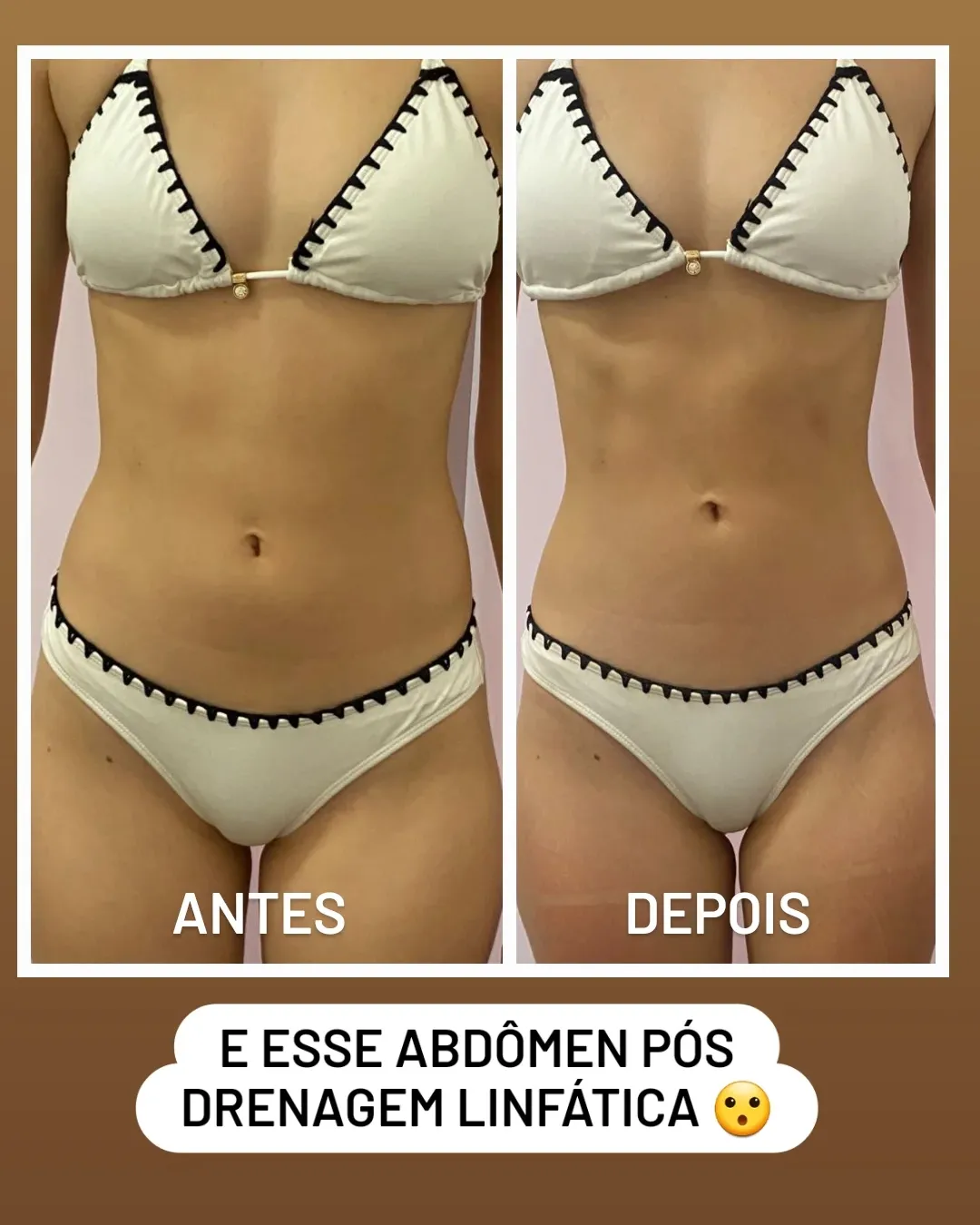 Resultado 3