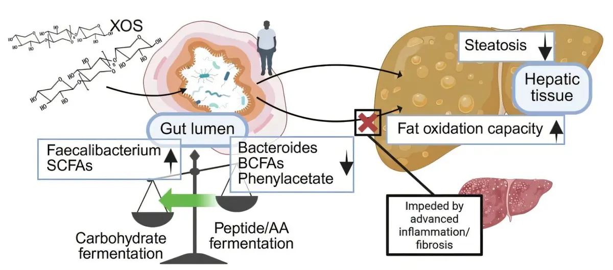 Dietary Fiber Supplement Shows Promise for Fatty Liver Disease