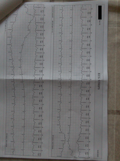 EKG-9