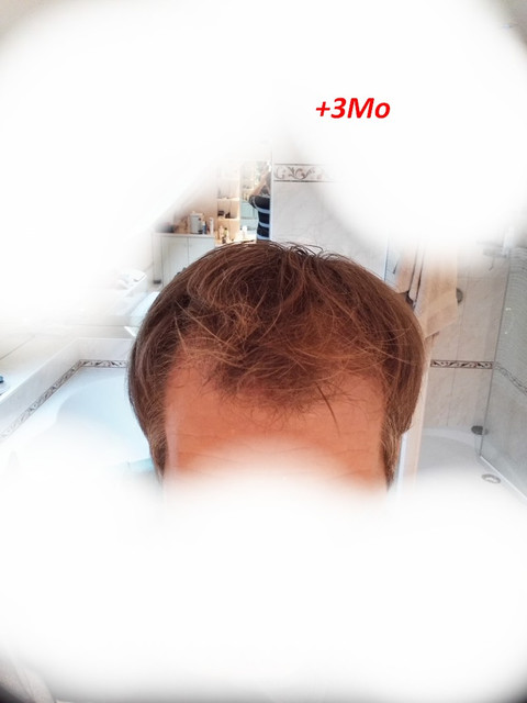 3Mo-2.jpg