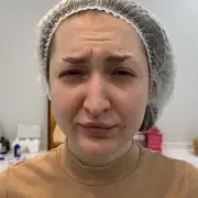 Межбровье до