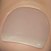 nail1b