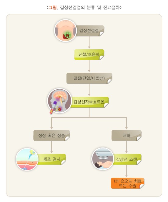 결절 분류