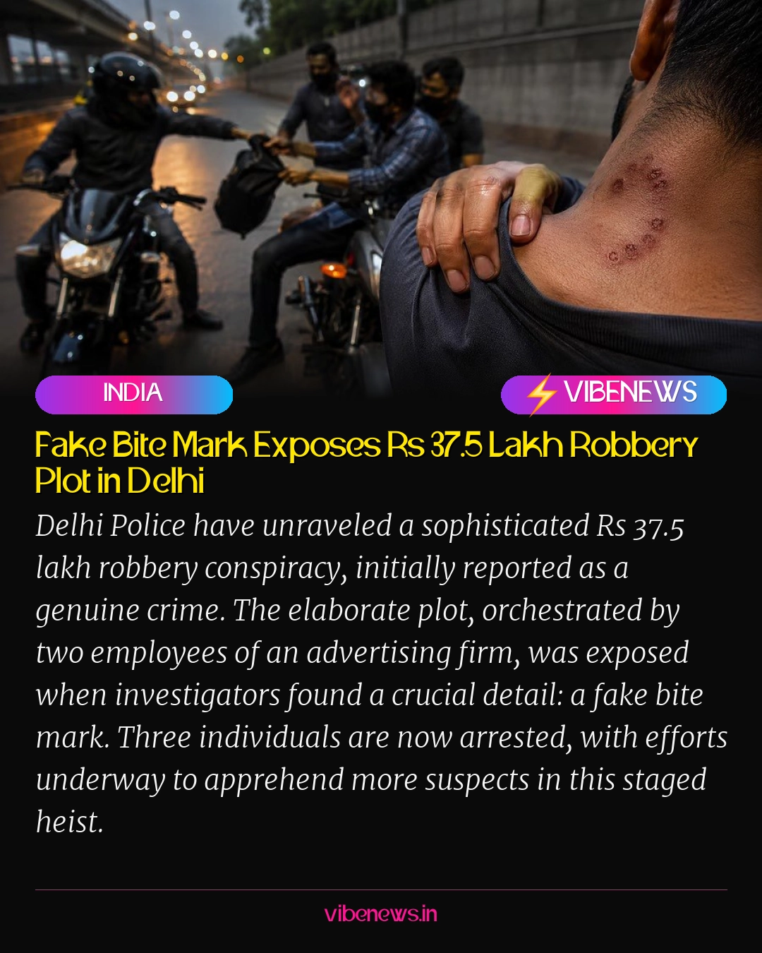 Fake Bite Mark Exposes Rs 37.5 Lakh Robbery Plot in Delhi
